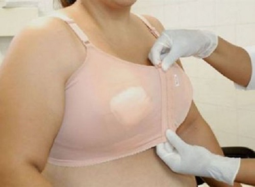 Feira de Santana: Hospital da Mulher realiza cirurgia de redução de mamas gratuitamente